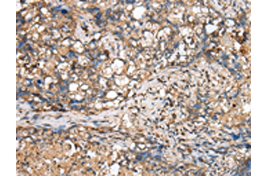 Immunohistochemistry - TINAGL1 Antibody from Signalway Antibody (43386) - Antibodies.com