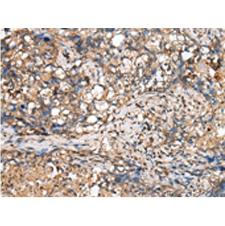 Immunohistochemistry - TINAGL1 Antibody from Signalway Antibody (43386) - Antibodies.com