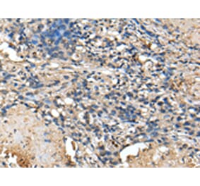 Immunohistochemistry - PRTFDC1 Antibody from Signalway Antibody (43388) - Antibodies.com