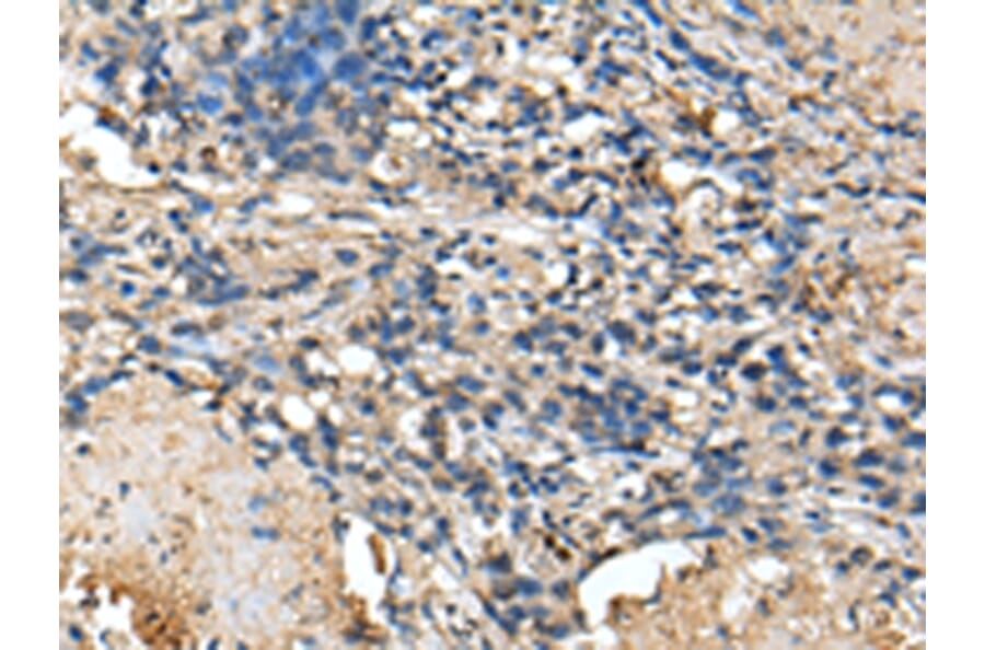 Immunohistochemistry - PRTFDC1 Antibody from Signalway Antibody (43388) - Antibodies.com