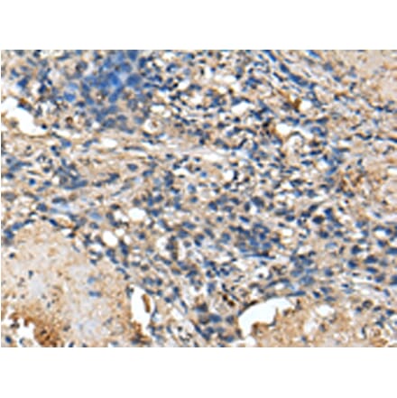 Immunohistochemistry - PRTFDC1 Antibody from Signalway Antibody (43388) - Antibodies.com