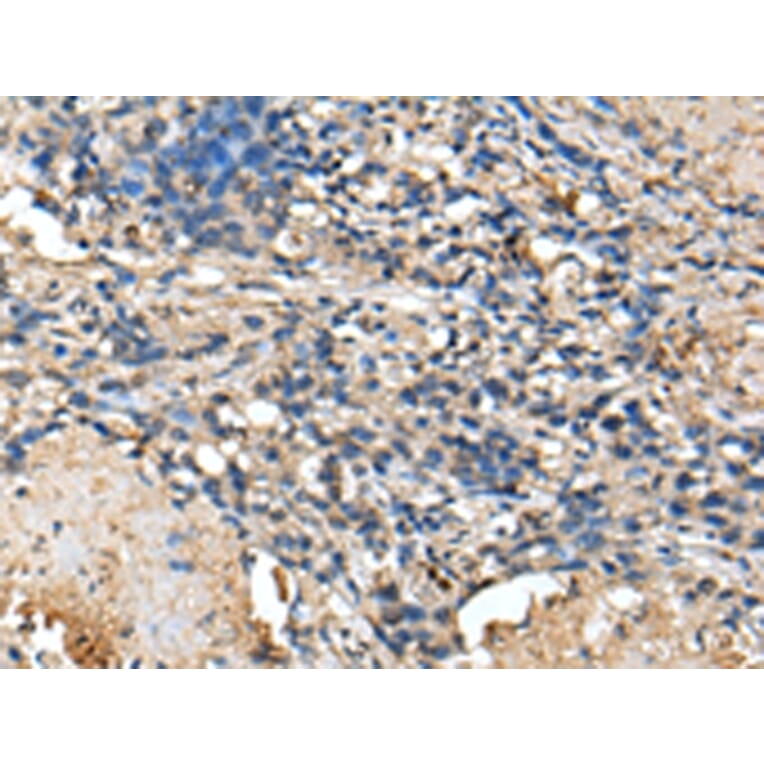 Immunohistochemistry - PRTFDC1 Antibody from Signalway Antibody (43388) - Antibodies.com