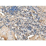 Immunohistochemistry - PRTFDC1 Antibody from Signalway Antibody (43388) - Antibodies.com