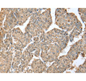 Immunohistochemistry - METTL7A Antibody from Signalway Antibody (43392) - Antibodies.com