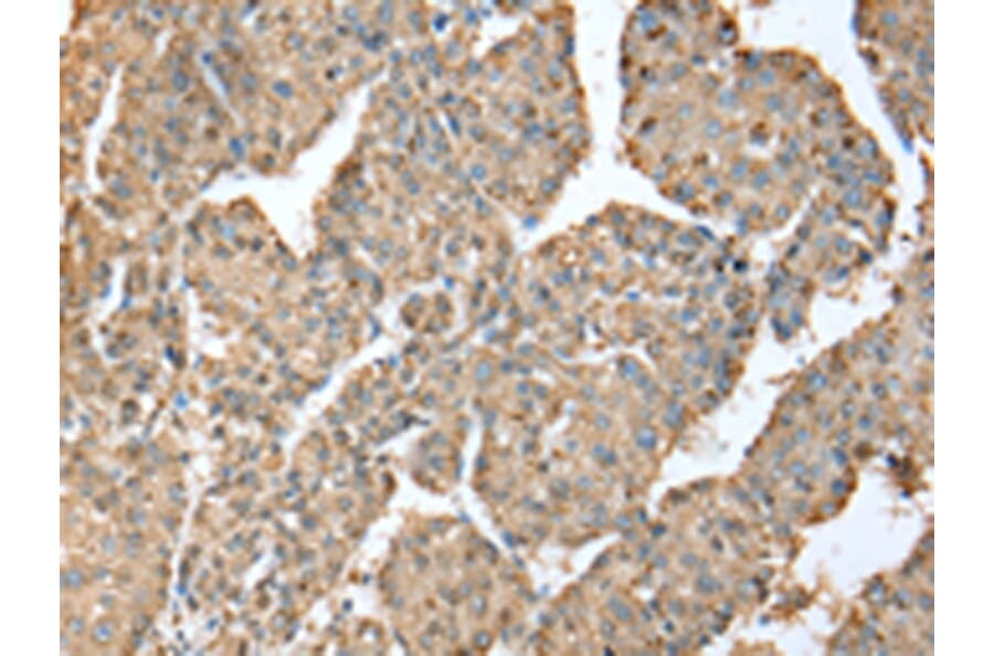 Immunohistochemistry - METTL7A Antibody from Signalway Antibody (43392) - Antibodies.com