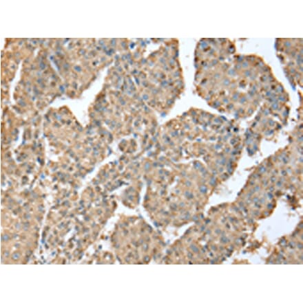 Immunohistochemistry - METTL7A Antibody from Signalway Antibody (43392) - Antibodies.com