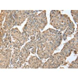 Immunohistochemistry - METTL7A Antibody from Signalway Antibody (43392) - Antibodies.com