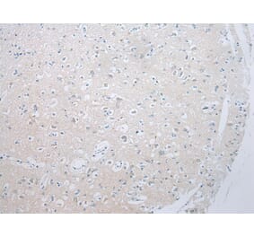 Immunohistochemistry - ADAMTS8 Antibody from Signalway Antibody (43467) - Antibodies.com