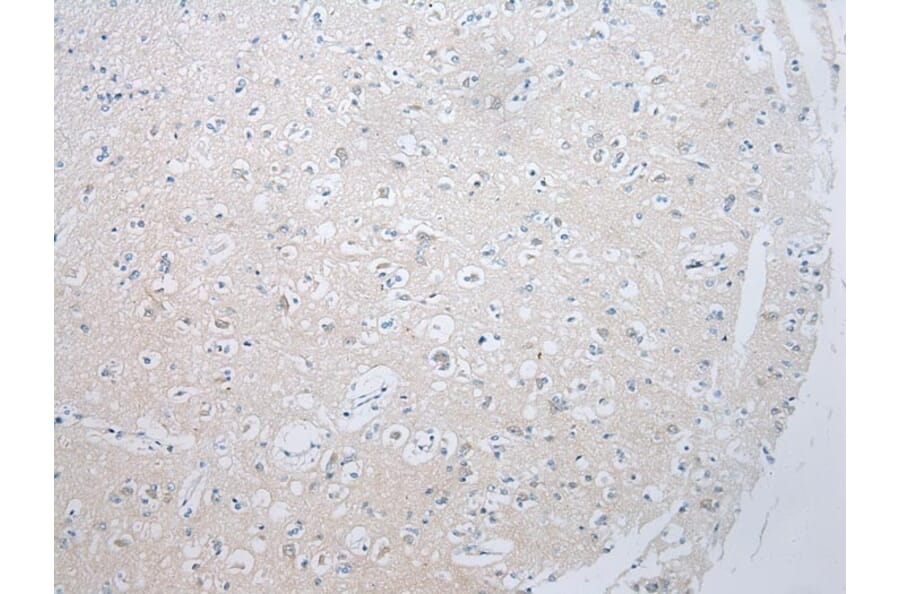 Immunohistochemistry - ADAMTS8 Antibody from Signalway Antibody (43467) - Antibodies.com