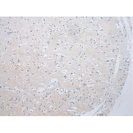 Immunohistochemistry - ADAMTS8 Antibody from Signalway Antibody (43467) - Antibodies.com
