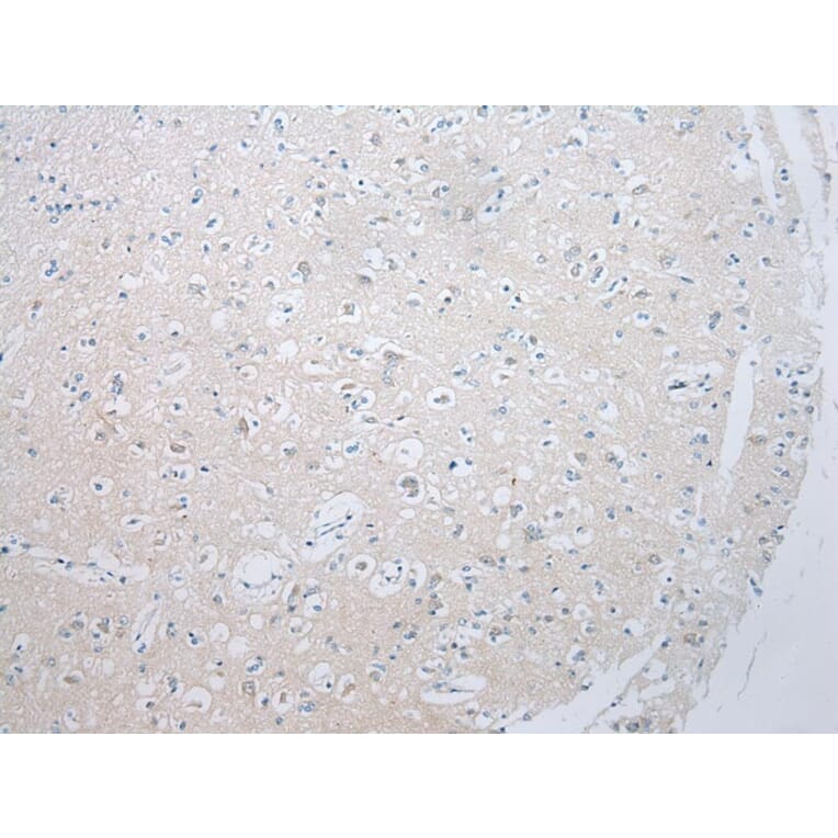 Immunohistochemistry - ADAMTS8 Antibody from Signalway Antibody (43467) - Antibodies.com