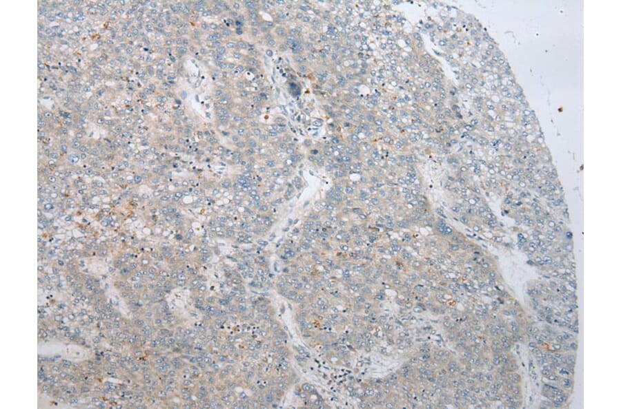 Immunohistochemistry - ADAMTS8 Antibody from Signalway Antibody (43467) - Antibodies.com