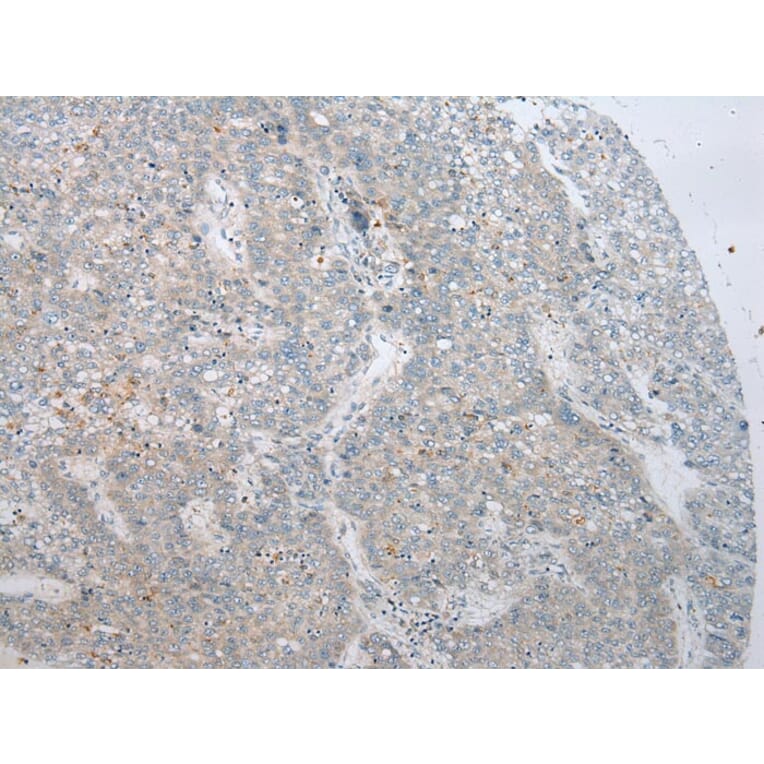 Immunohistochemistry - ADAMTS8 Antibody from Signalway Antibody (43467) - Antibodies.com