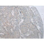 Immunohistochemistry - ADAMTS8 Antibody from Signalway Antibody (43467) - Antibodies.com