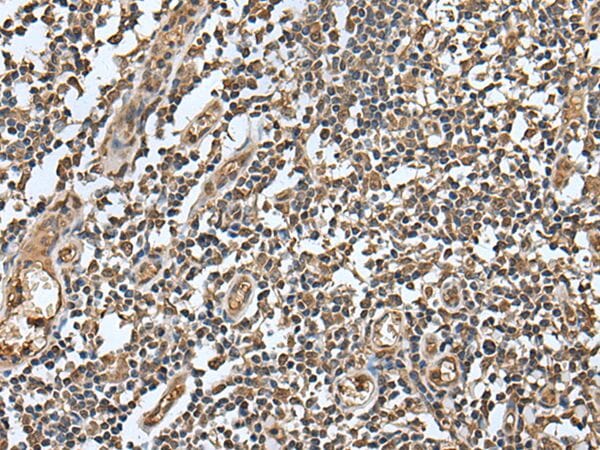 The image on the left is immunohistochemistry of paraffin-embedded Human tonsil tissue using LAMTOR5 Antibody at dilution 1/100, on the right is treated with fusion protein. (Original magnification: x200)