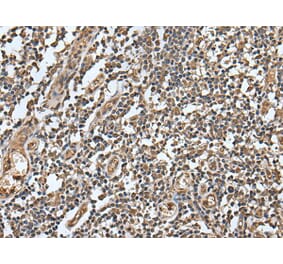 LAMTOR5 Antibody from Signalway Antibody (43518) - Antibodies.com
