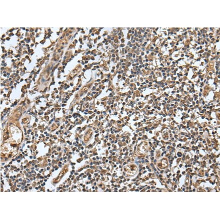 LAMTOR5 Antibody from Signalway Antibody (43518) - Antibodies.com