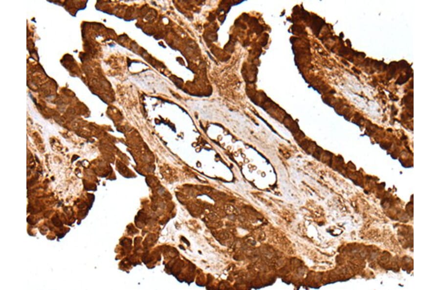 LAMTOR5 Antibody from Signalway Antibody (43518) - Antibodies.com