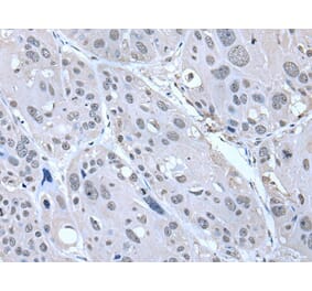 SERTAD1 Antibody from Signalway Antibody (43536) - Antibodies.com