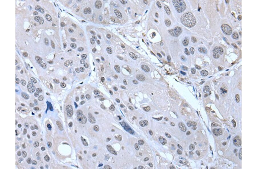 SERTAD1 Antibody from Signalway Antibody (43536) - Antibodies.com