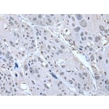 SERTAD1 Antibody from Signalway Antibody (43536) - Antibodies.com