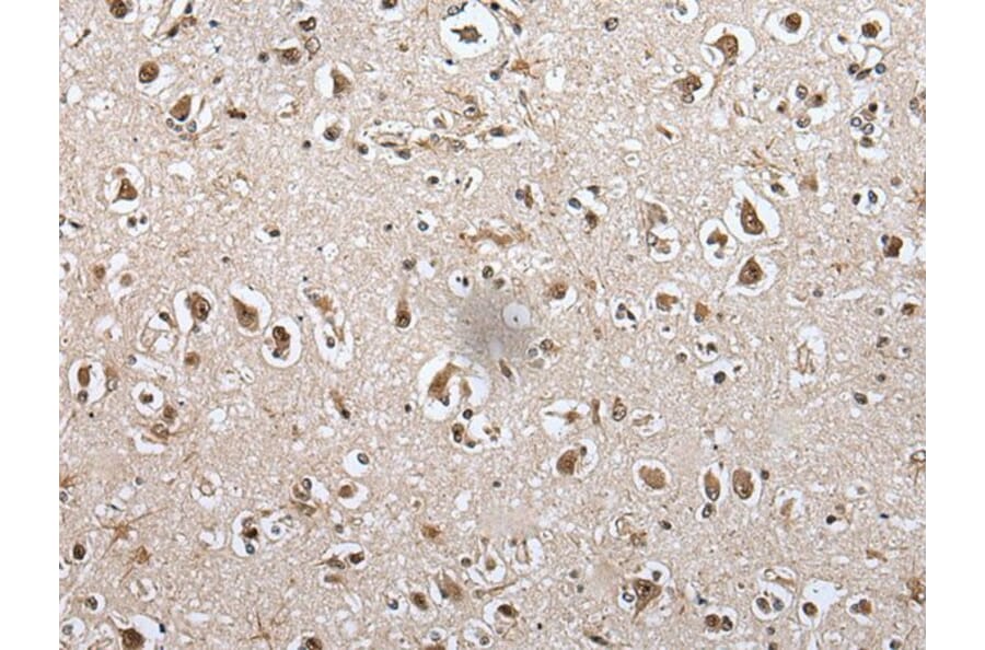 METAP1D Antibody from Signalway Antibody (43549) - Antibodies.com