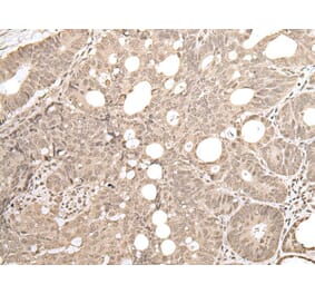 ZKSCAN3 Antibody from Signalway Antibody (43570) - Antibodies.com