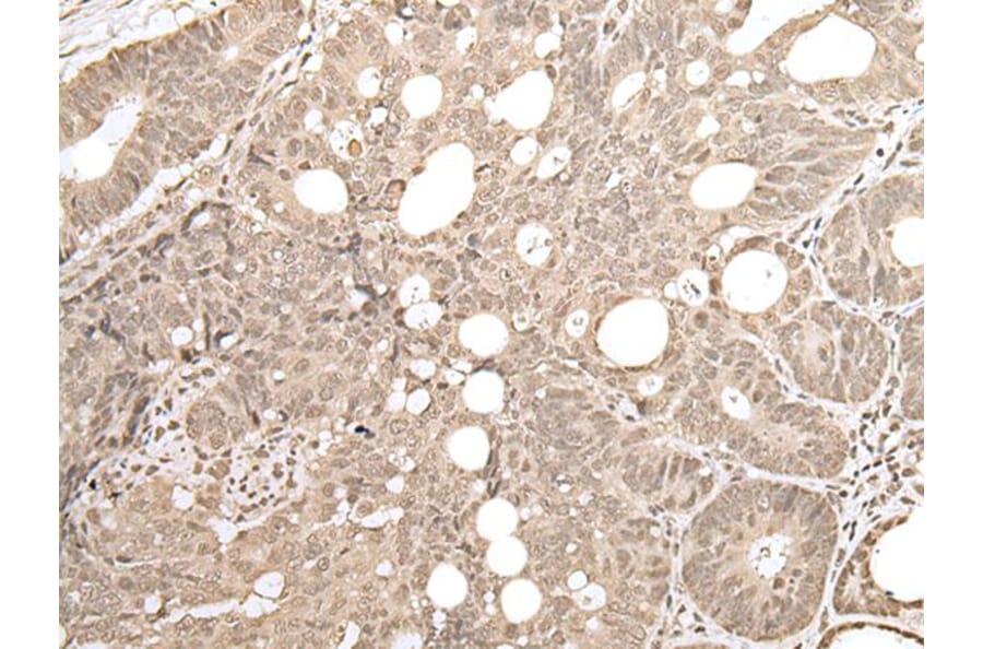 ZKSCAN3 Antibody from Signalway Antibody (43570) - Antibodies.com