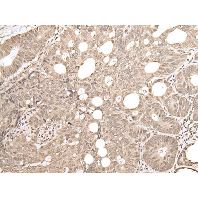 ZKSCAN3 Antibody from Signalway Antibody (43570) - Antibodies.com