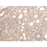 ZKSCAN3 Antibody from Signalway Antibody (43570) - Antibodies.com