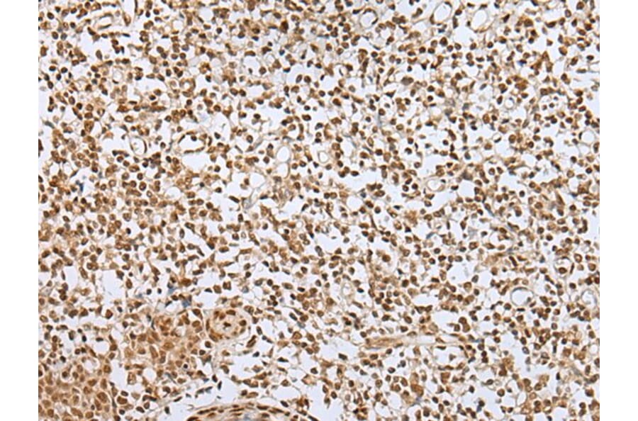 ZNF354A Antibody from Signalway Antibody (43580) - Antibodies.com