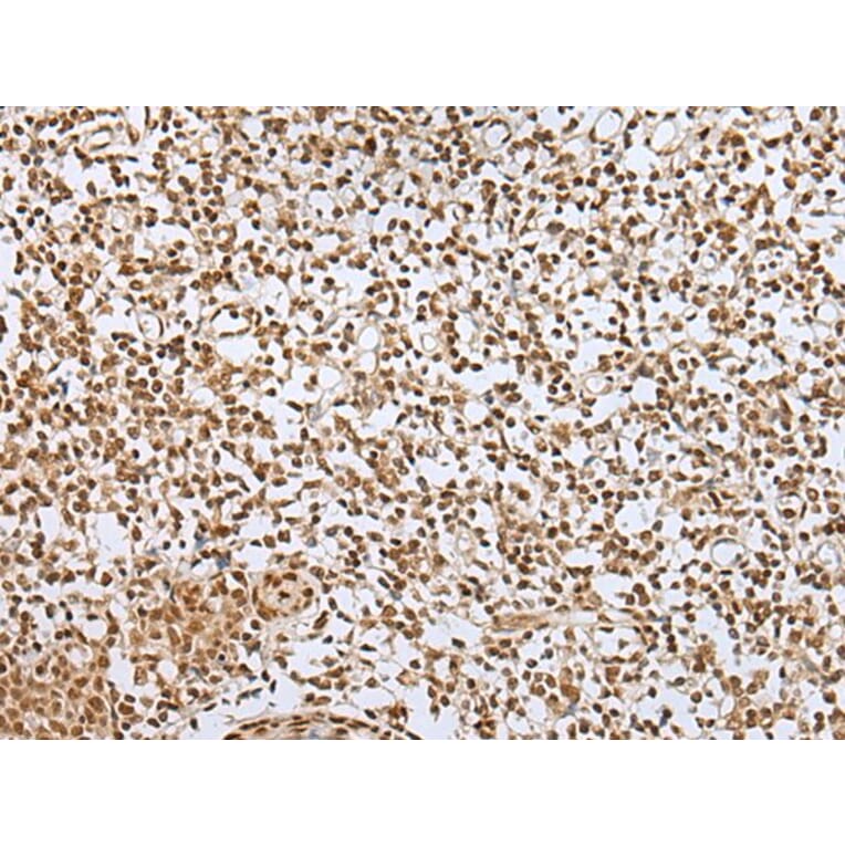 ZNF354A Antibody from Signalway Antibody (43580) - Antibodies.com