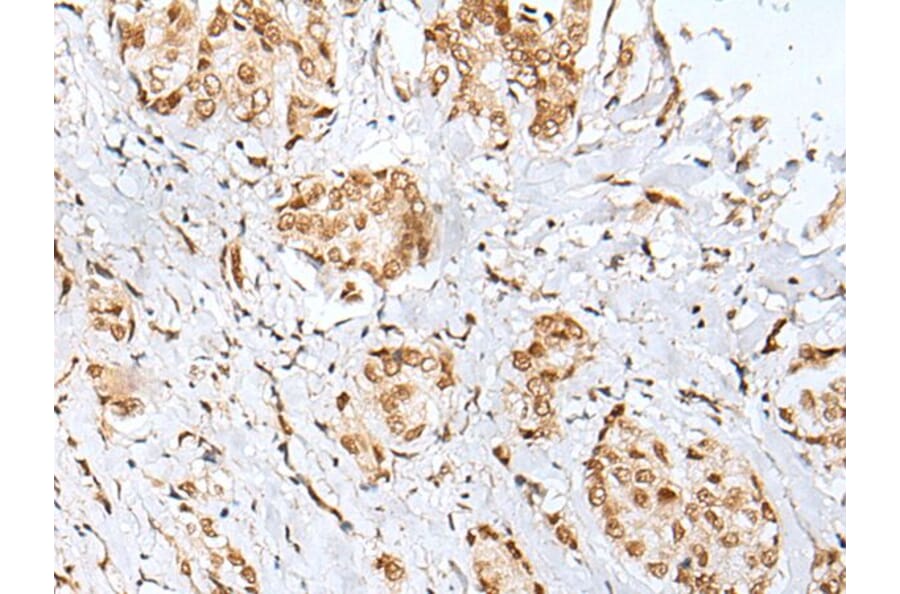 ZNF354A Antibody from Signalway Antibody (43580) - Antibodies.com