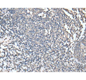 UBASH3A Antibody from Signalway Antibody (43599) - Antibodies.com