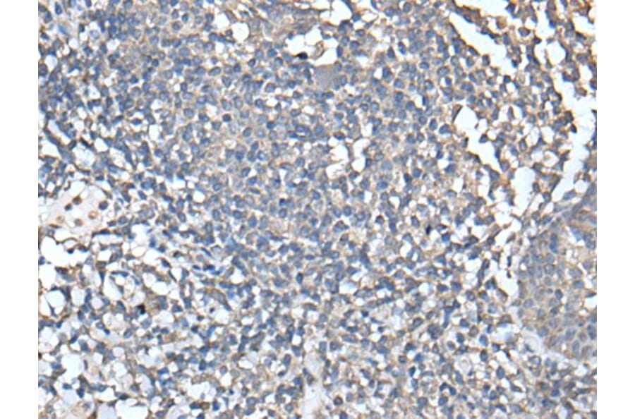 UBASH3A Antibody from Signalway Antibody (43599) - Antibodies.com