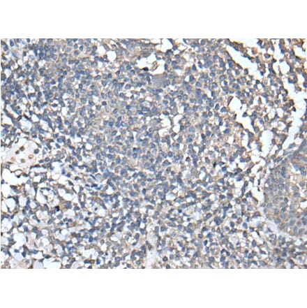 UBASH3A Antibody from Signalway Antibody (43599) - Antibodies.com