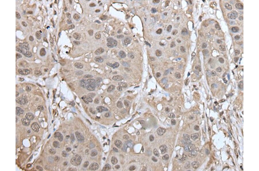 UBASH3A Antibody from Signalway Antibody (43599) - Antibodies.com