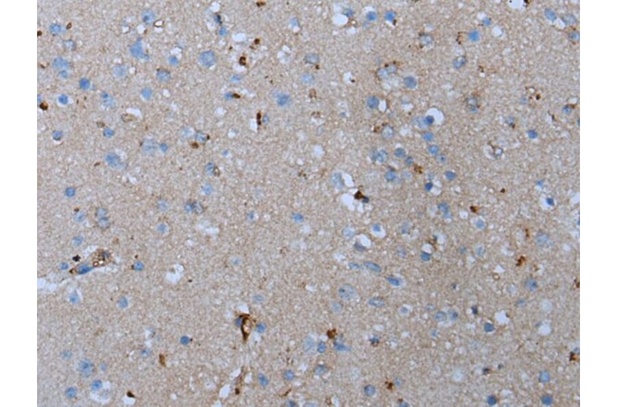 ADORA2B Antibody from Signalway Antibody (43632) - Antibodies.com