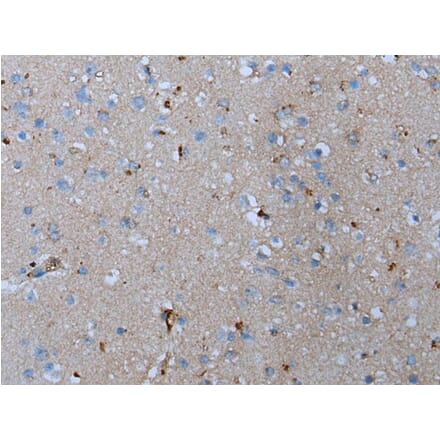 ADORA2B Antibody from Signalway Antibody (43632) - Antibodies.com