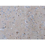 ADORA2B Antibody from Signalway Antibody (43632) - Antibodies.com