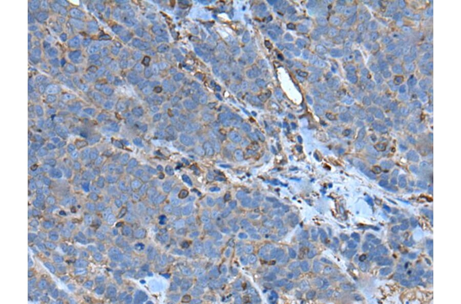 SLC24A5 Antibody from Signalway Antibody (43635) - Antibodies.com