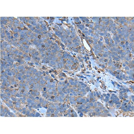 SLC24A5 Antibody from Signalway Antibody (43635) - Antibodies.com