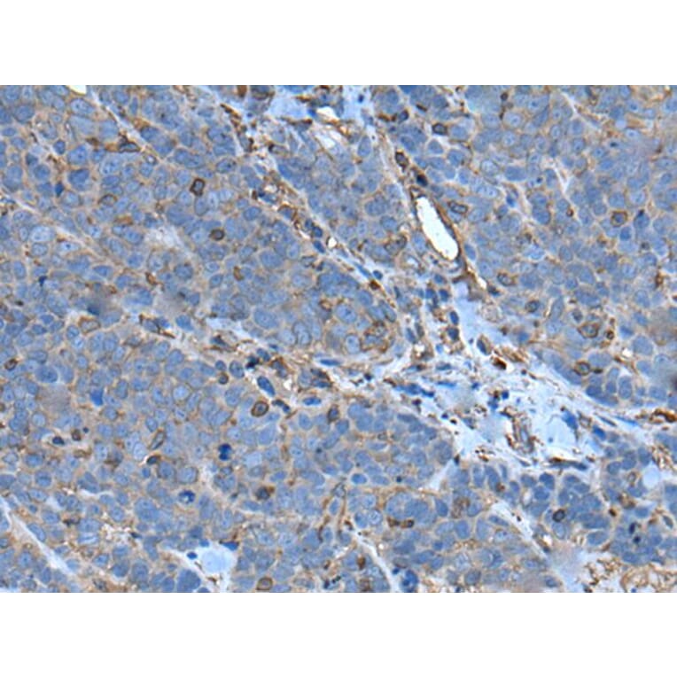 SLC24A5 Antibody from Signalway Antibody (43635) - Antibodies.com