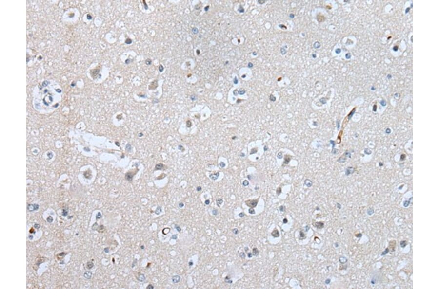 SLC5A10 Antibody from Signalway Antibody (43636) - Antibodies.com