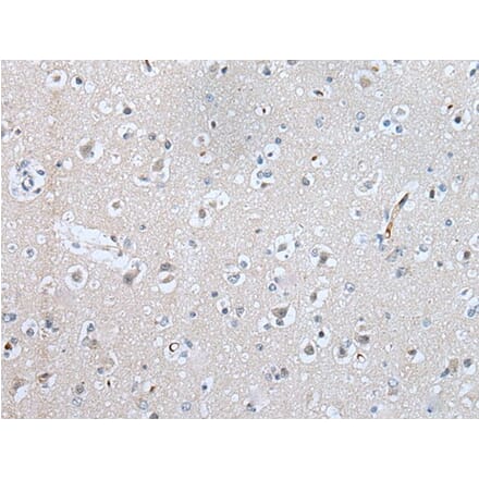 SLC5A10 Antibody from Signalway Antibody (43636) - Antibodies.com