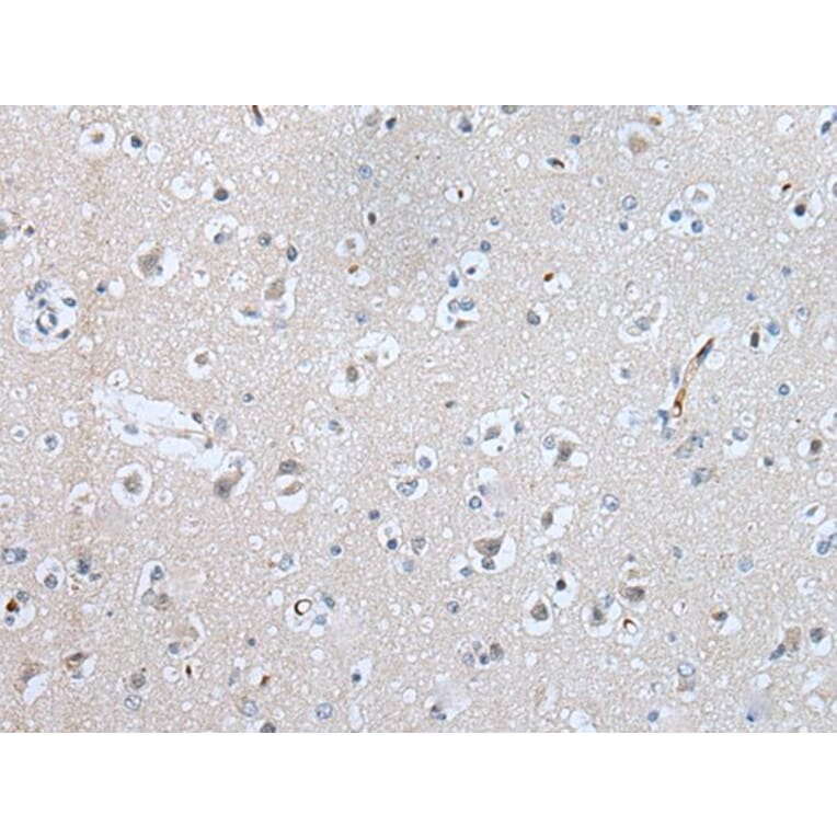 SLC5A10 Antibody from Signalway Antibody (43636) - Antibodies.com