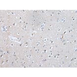 SLC5A10 Antibody from Signalway Antibody (43636) - Antibodies.com