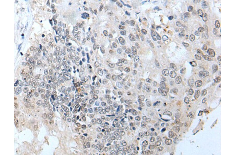 SLC5A10 Antibody from Signalway Antibody (43636) - Antibodies.com