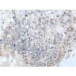 SLC5A10 Antibody from Signalway Antibody (43636) - Antibodies.com