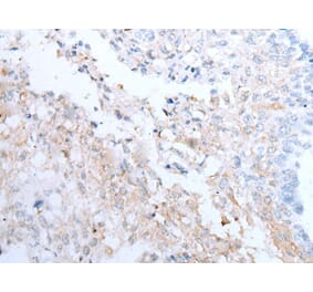 CLEC14A Antibody from Signalway Antibody (43651) - Antibodies.com